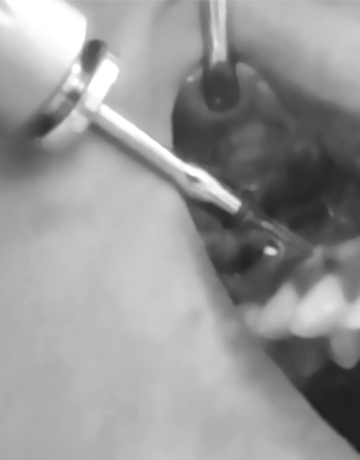 Formation Orthodontie