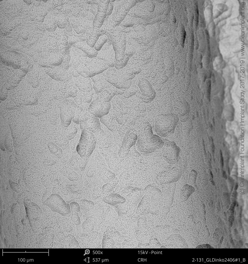 Clean Implant Foundation passe au crible l’implant dentaire In-Kone®