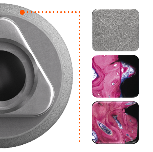 Conceptos de producto_Implantología Tissue Level_SA2 y Cápsulas MEB twinKon®