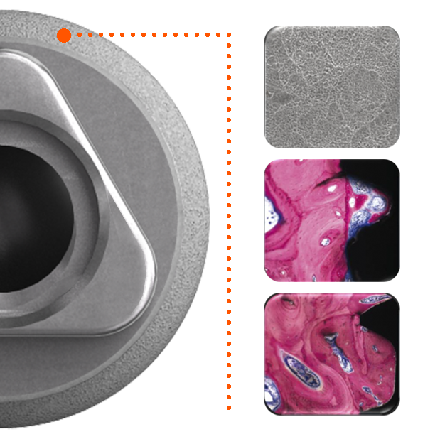 SA2 et Capsules MEB twinKon®