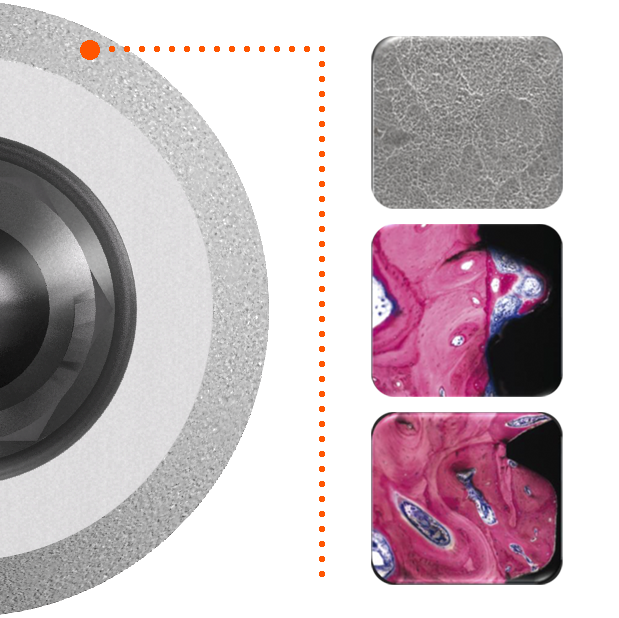 Korony In-Kone® SA2 i 3 oraz SEM