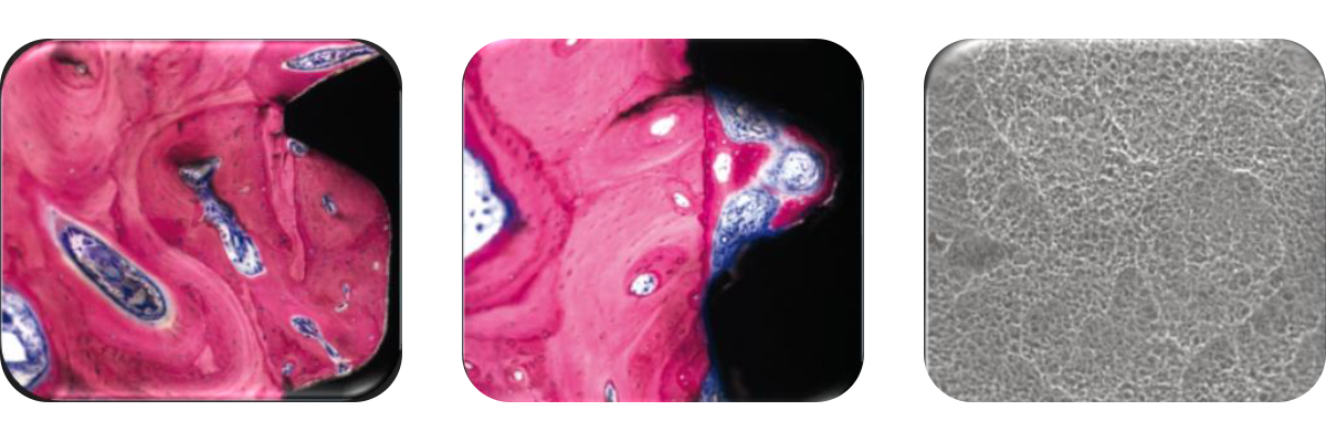 Clinical Experiences_SA2 Crowns