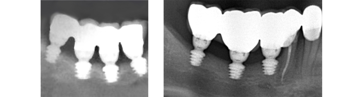 Obraz radiologiczny twinKon®