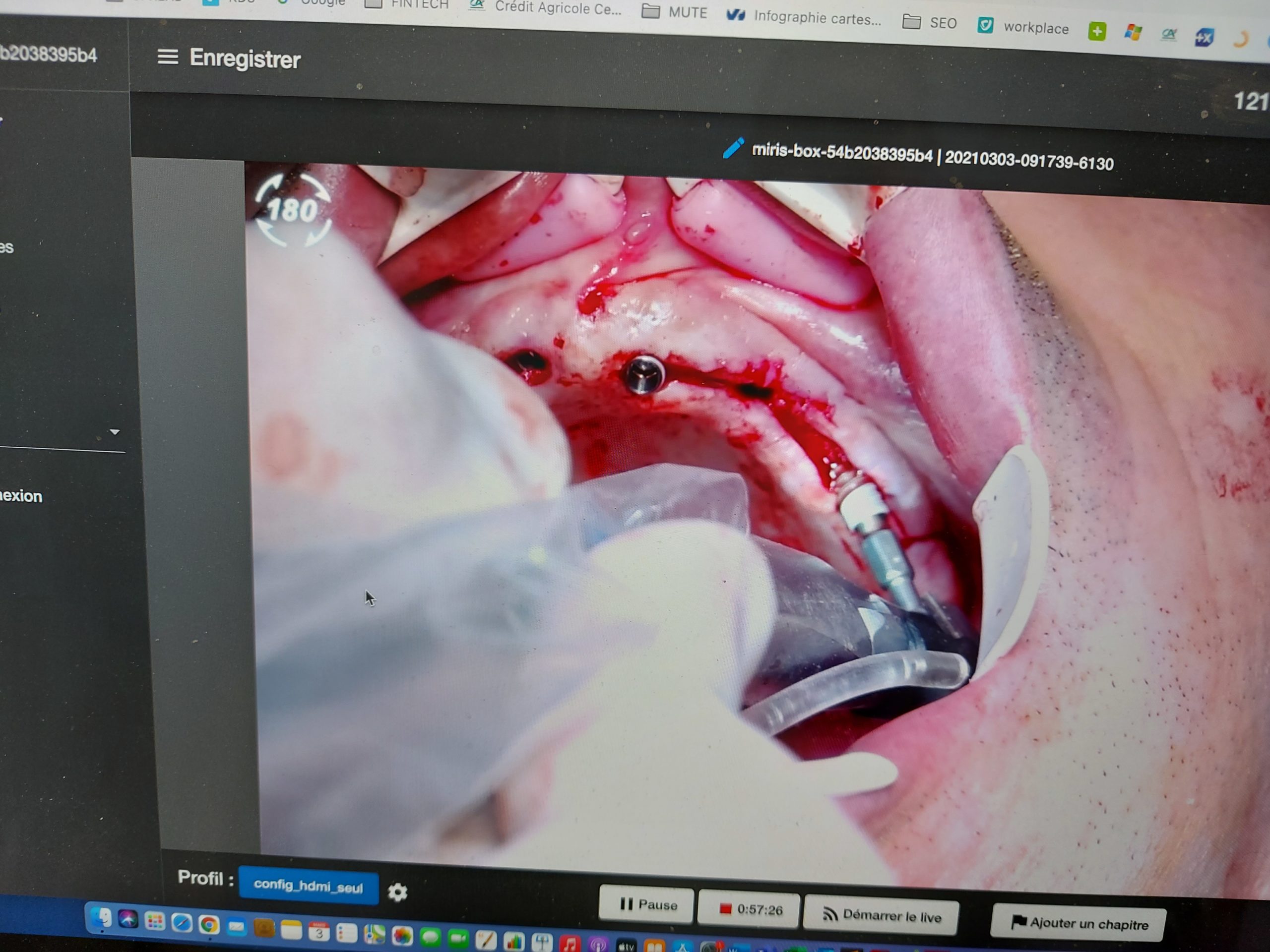 Backstage of Les Printanières 2021