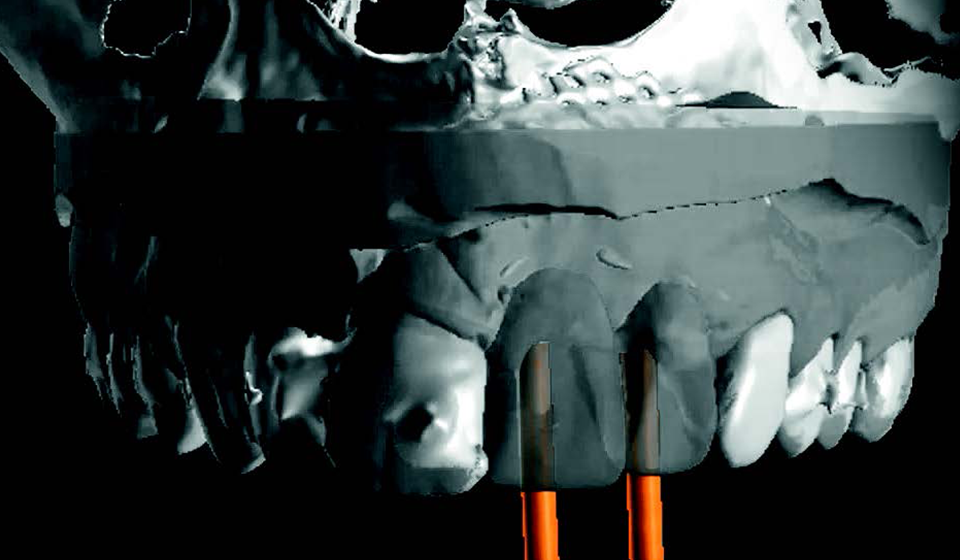 Planification_Chirurgie Pilotée