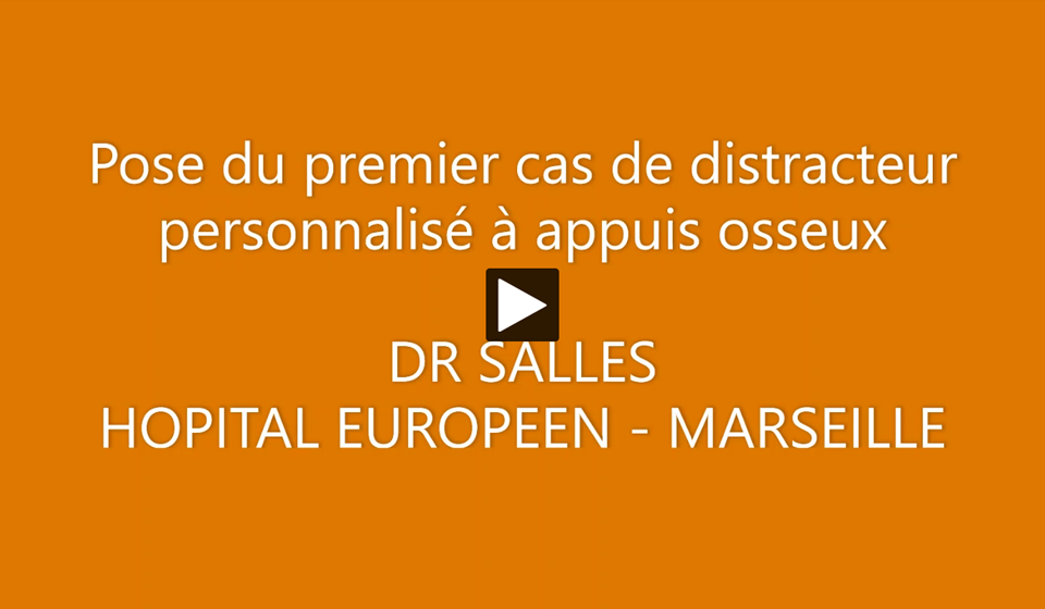 Pose du 1er cas de distracteur personnalisé à appuis osseux