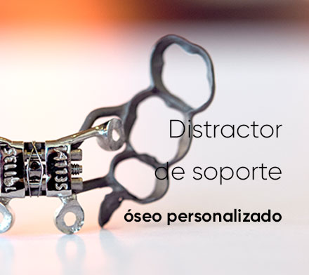 Enfoque En_Distractor De Soporte Oseo Personalizado