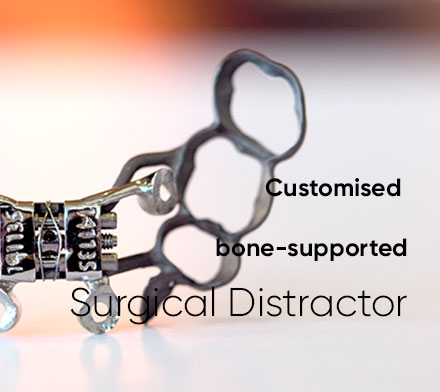 Focus-On_Customised-Bone-Supported-Surgical-Distractor