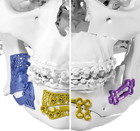 CMF-Guides et plaques
