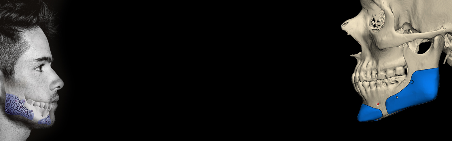 Planification numérique esthétique sur mesure Global&nbsp;D