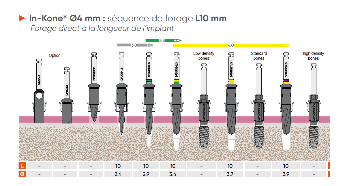 In-Kone 4mm diameter drilling protocol: drilling sequence Length 10 mm